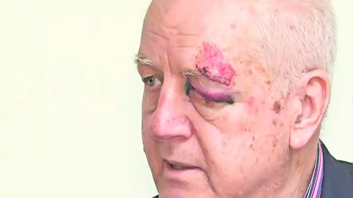 Jean Pădureanu, şeful Gloriei Bistriţa, a fost agresat şi jefuit ieri în Bucureşti, înaintea meciului cu Steaua. I-a umflat ochiul lui «tata Jean»
