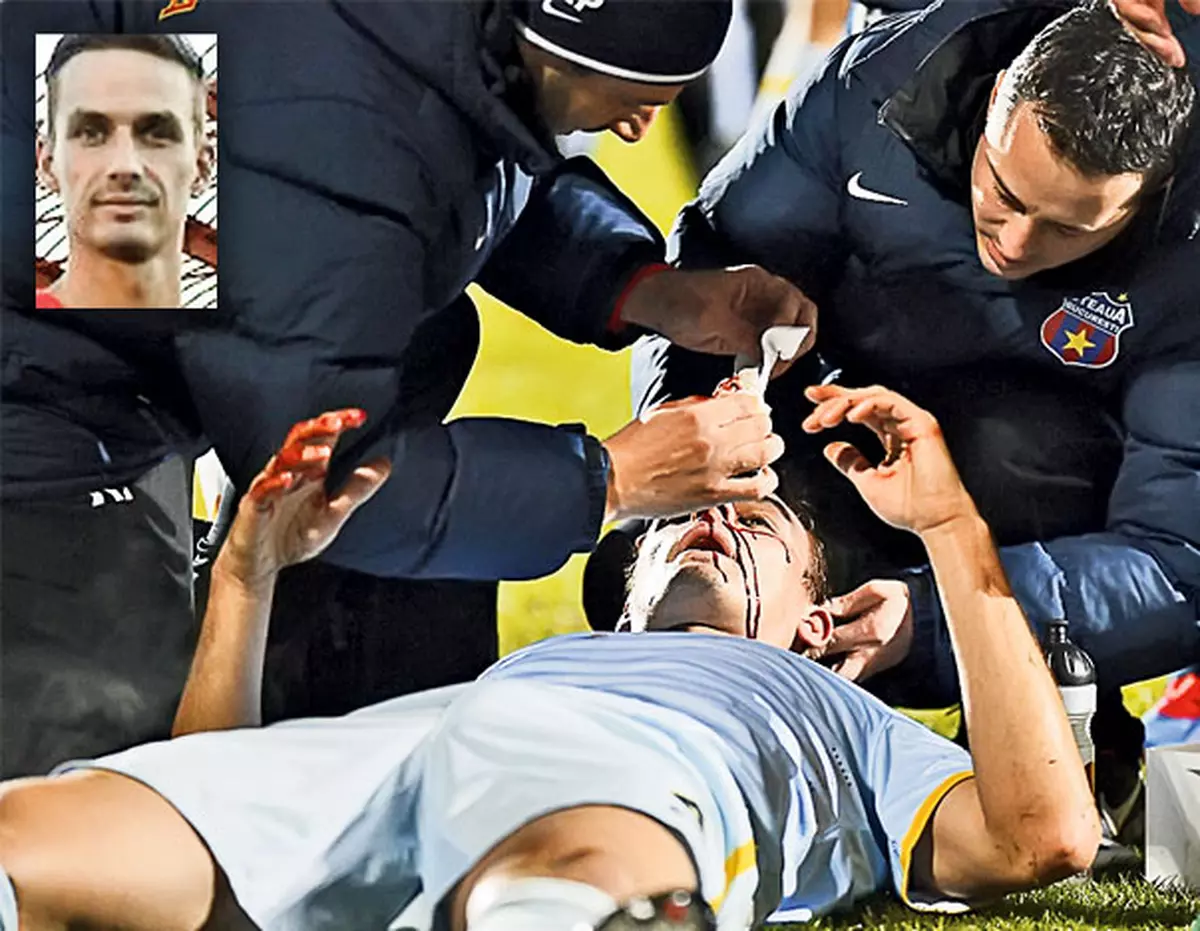 Lukasz şi-a luat-o în nas | Stoperul polonez e suspect de fractură de piramidă nazală
