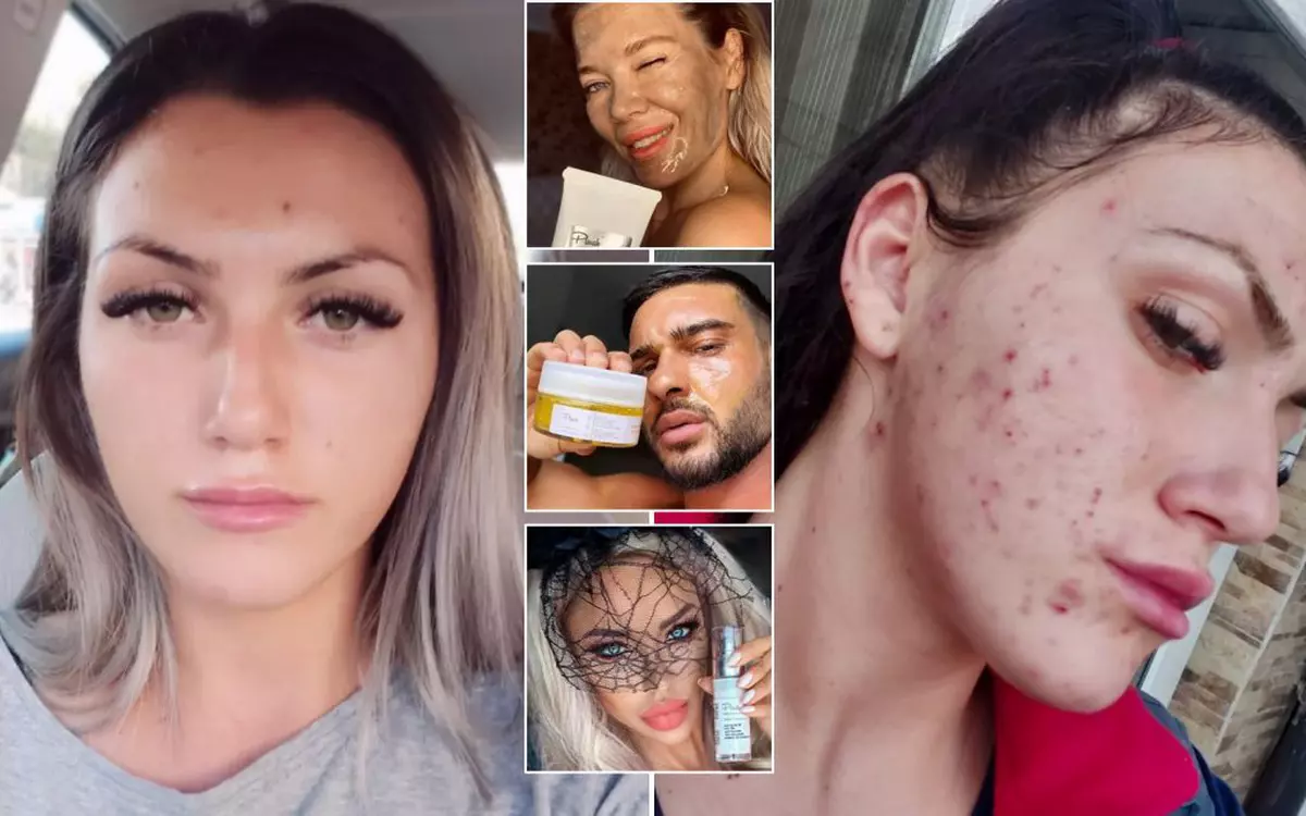 „Fața mea a început să se descompună. Un fals dermatolog e acuzat că a vândut produse toxice pentru ten, promovate de vedete precum Dorian Popa și Gina Pistol. Mai multe victime au făcut plângere