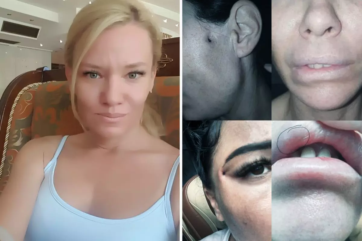 Pedeapsa primită de „Dr. Lana, dentista din Republica Moldova judecată pentru că făcea operații estetice în România fără drept de practică