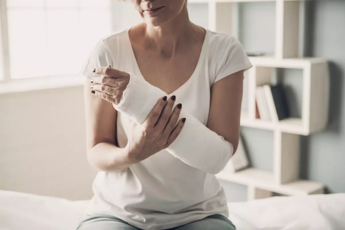 Cum este corect: gips sau ghips - Imagine cu o femeie care are mâna în ghips.