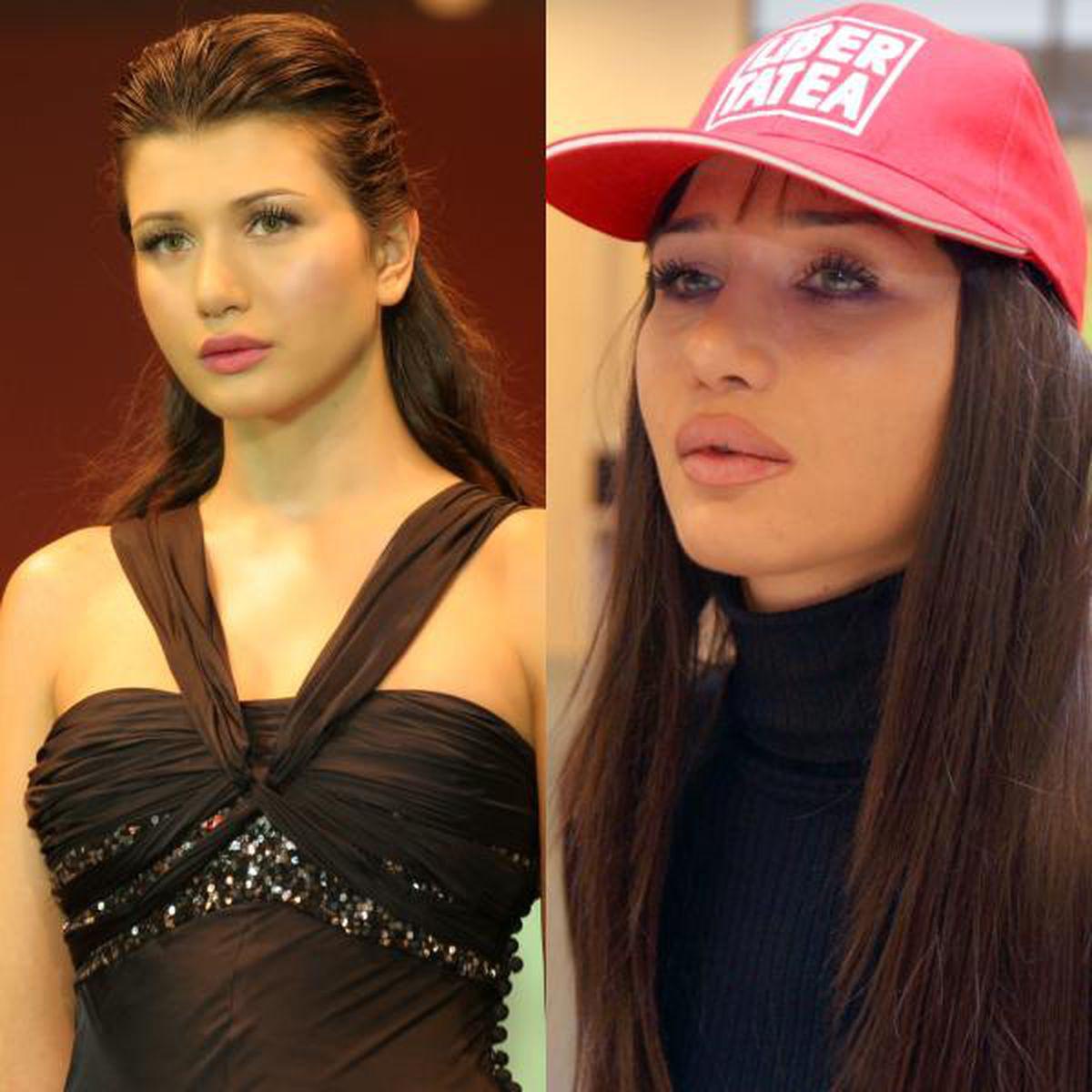 6 Vedete Inainte Si După Mărirea Buzelor Cum Arată Mai Bine Entertainment Monden Libertatea Libertatea