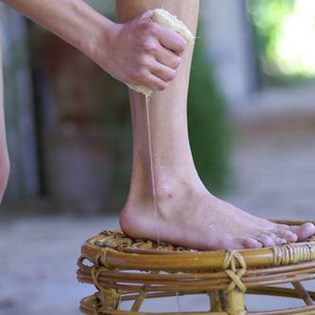 picioarele de gimnastica cu videoclipuri varicoase venele varicoase semneaza tratamentul