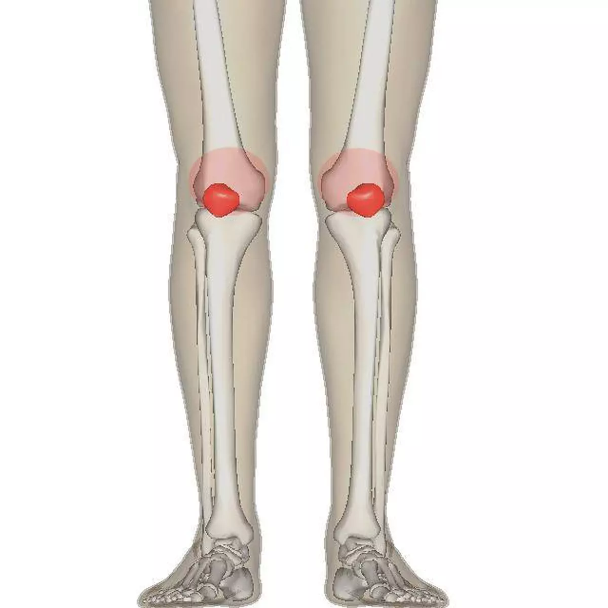 durere articulară osteoporoză unguent pentru durerea articulațiilor coatelor