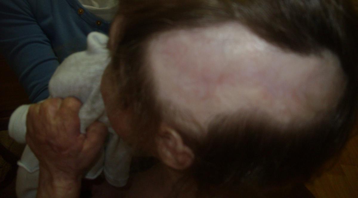 Noua expertiză medico-legală în cazul "Maternitatea Bucur" a fost finalizată: Copilul ars în incubator, sluţit permanent