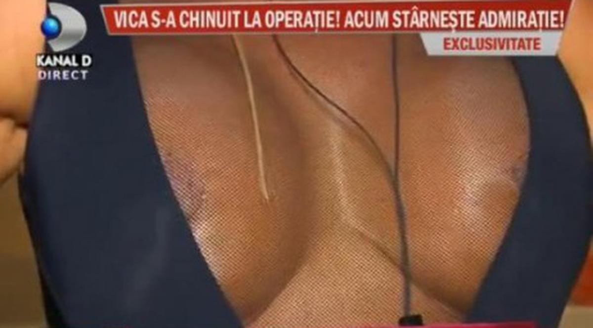 Vica Blochina şi-a arătat silicoanele: "Mi-au ieşit perfect!" Tu ce părere ai?