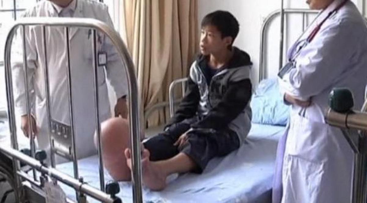 Un copil din China a ŞOCAT lumea medicală! Vezi ce boală rară are şi cum îi arată picioarele! | VIDEO