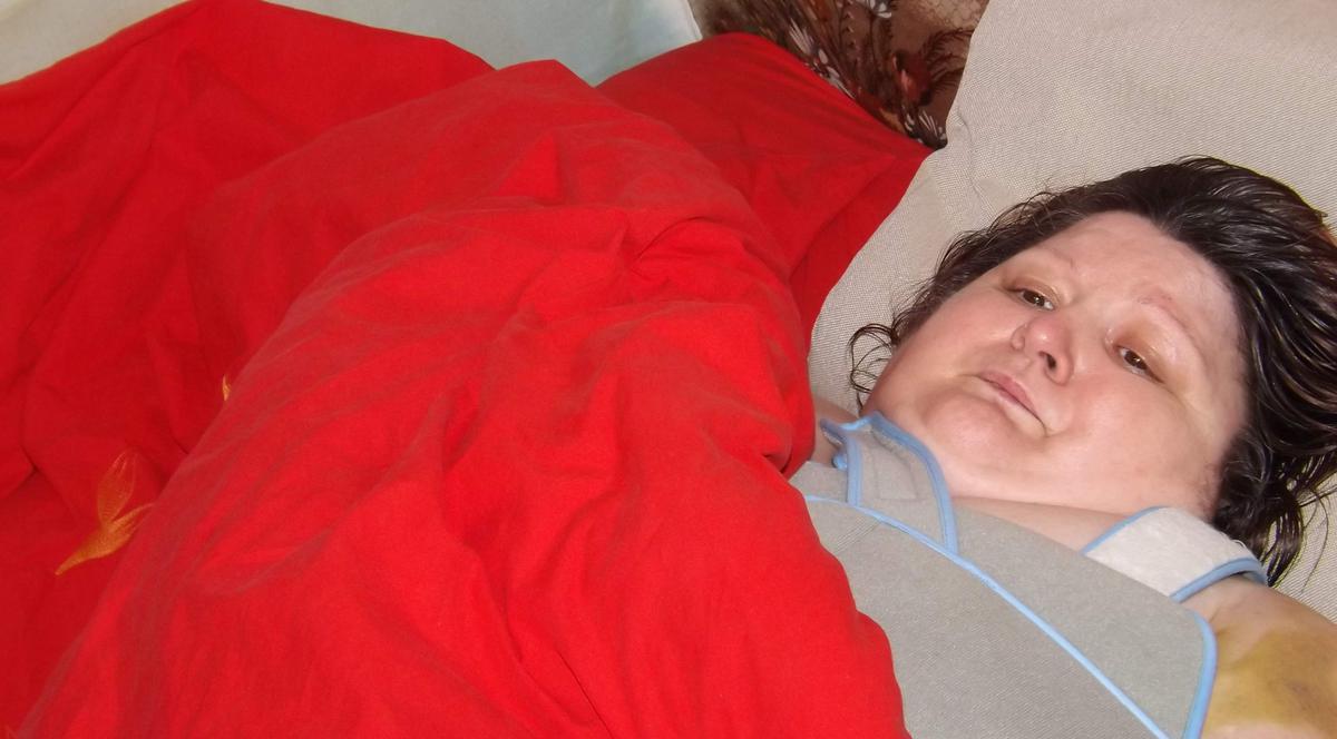 ACUZAŢII GRAVE DE MALPRAXIS: "Mi-am pierdut piciorul din cauza unui medic ortoped" | IMAGINI ŞOCANTE