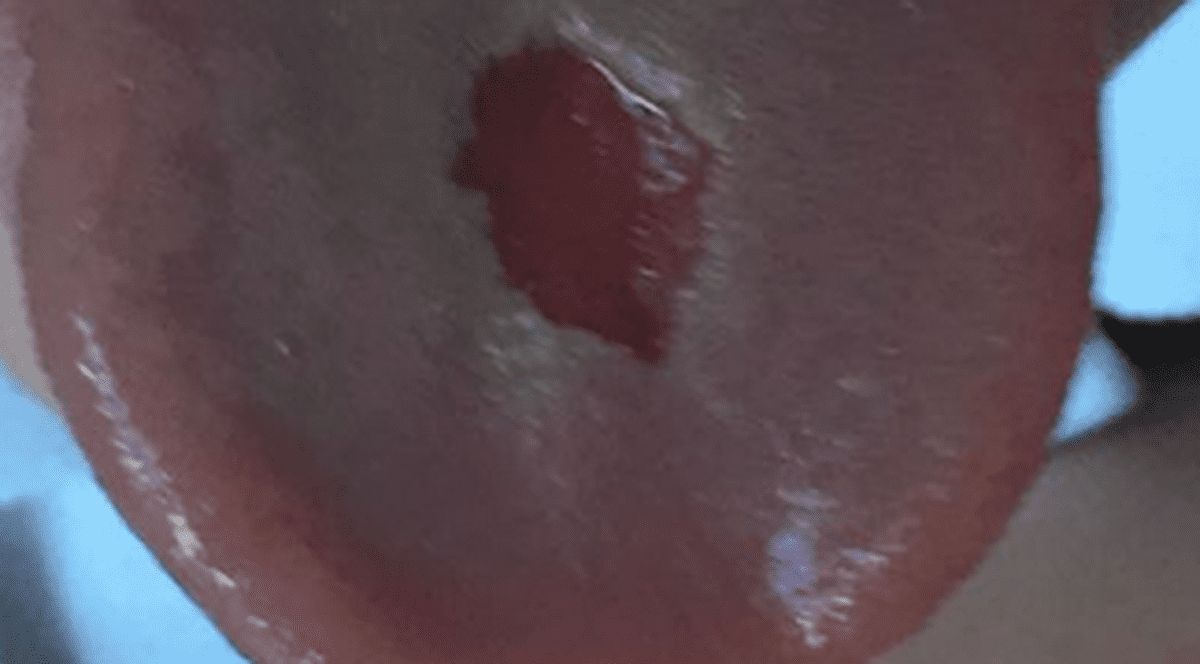 CAZ ȘOCANT! Un băiețel și-a ars LIMBA CU BOMBOANE! Mama COPILULUI declară RĂZBOI PRODUCĂTORULUI