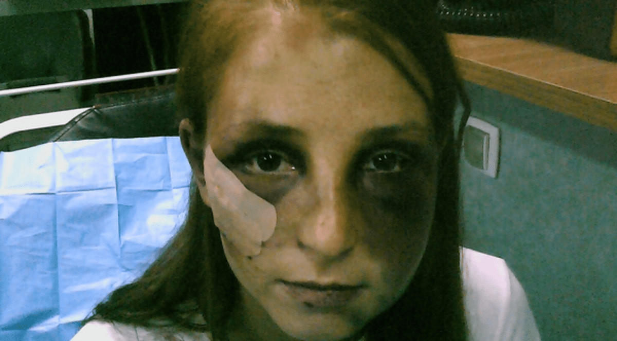 Bărbatul care şi-a bătut iubita timp de 22 de ore A FOST ARESTAT. Ce le-a spus poliţiştilor