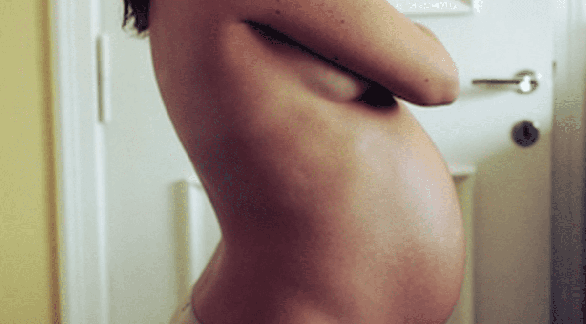 A dat medicul în judecată pentru că nu a născut o fetiţă blondă cu ochi albaştri. Cum arată copilul acestei femei