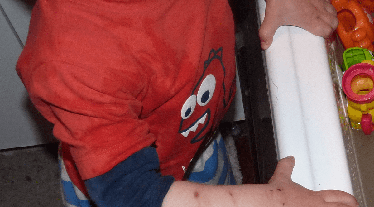 10.000 de euro pentru un băiețel mușcat și târât de maidanezi