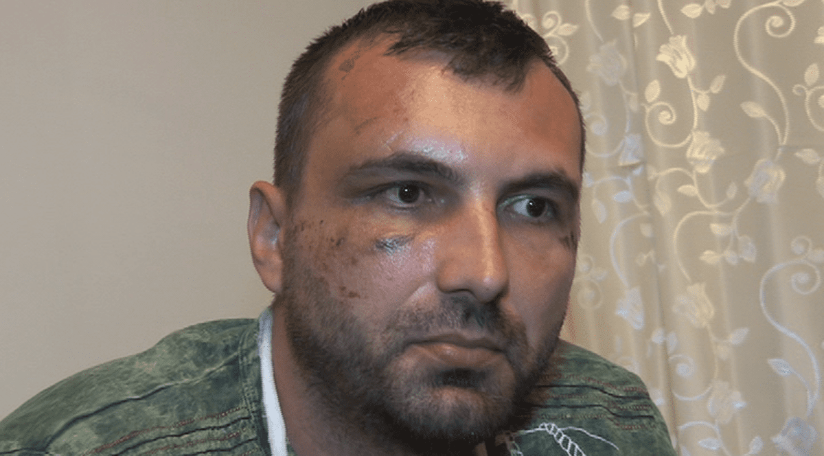 ACUZAȚII GRAVE! Un gorjean susține că a fost bătut de mascați până când i s-a făcut rău