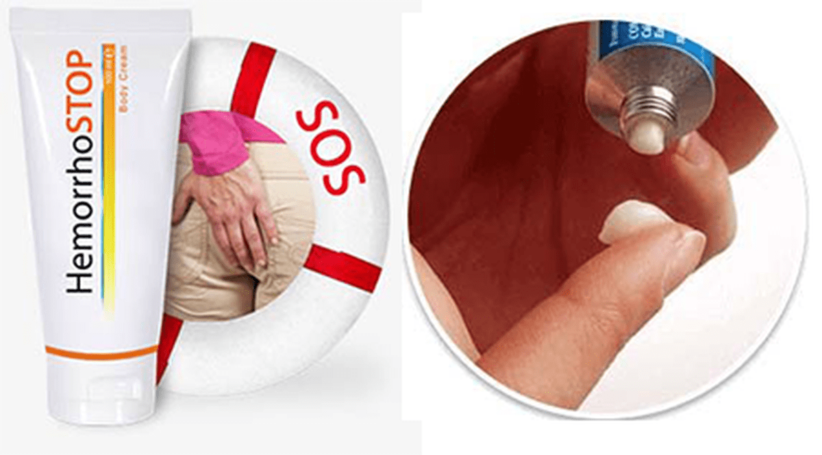 Crema HemorrhoSTOP ne ajuta sa scapam de hemoroizi