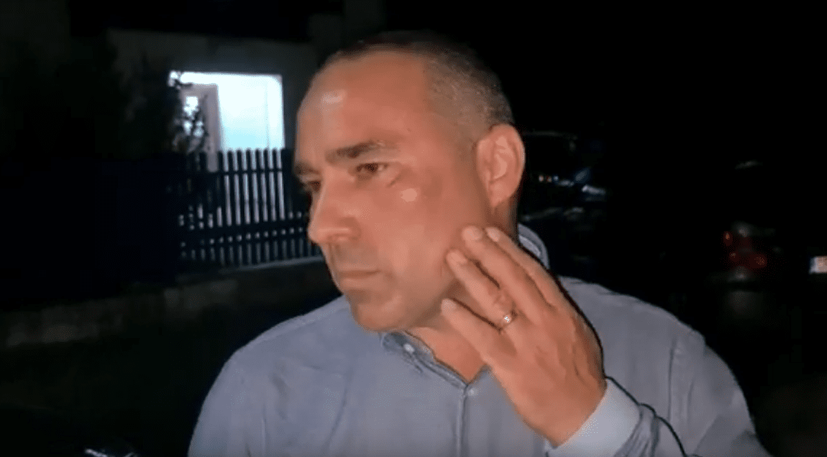 Un edil din Dâmbovița susține că a fost bătut de un localnic pe care l-a prins că arunca deșeuri: "Mi-a dat în falcă"