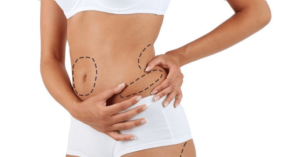 Liposculptura 3D cu Vibrasat Pro - Artă și Precizie în Conturarea Corpului