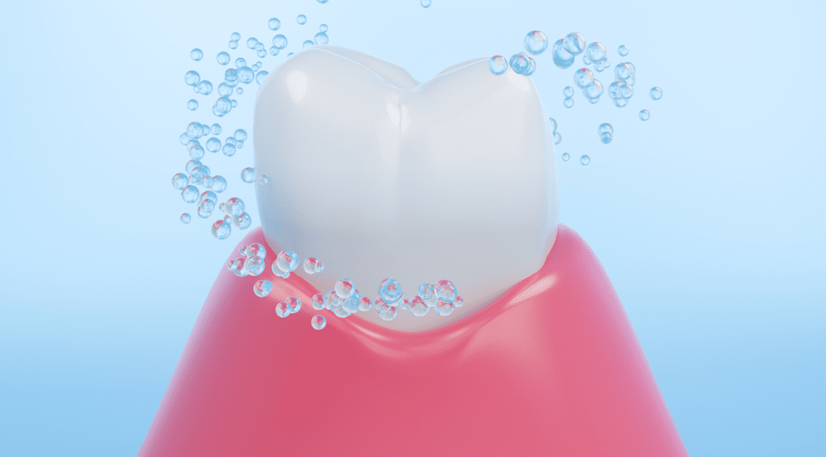 Sănătate dentară de la A la Z: implant dentar și tratamente de ortodonție