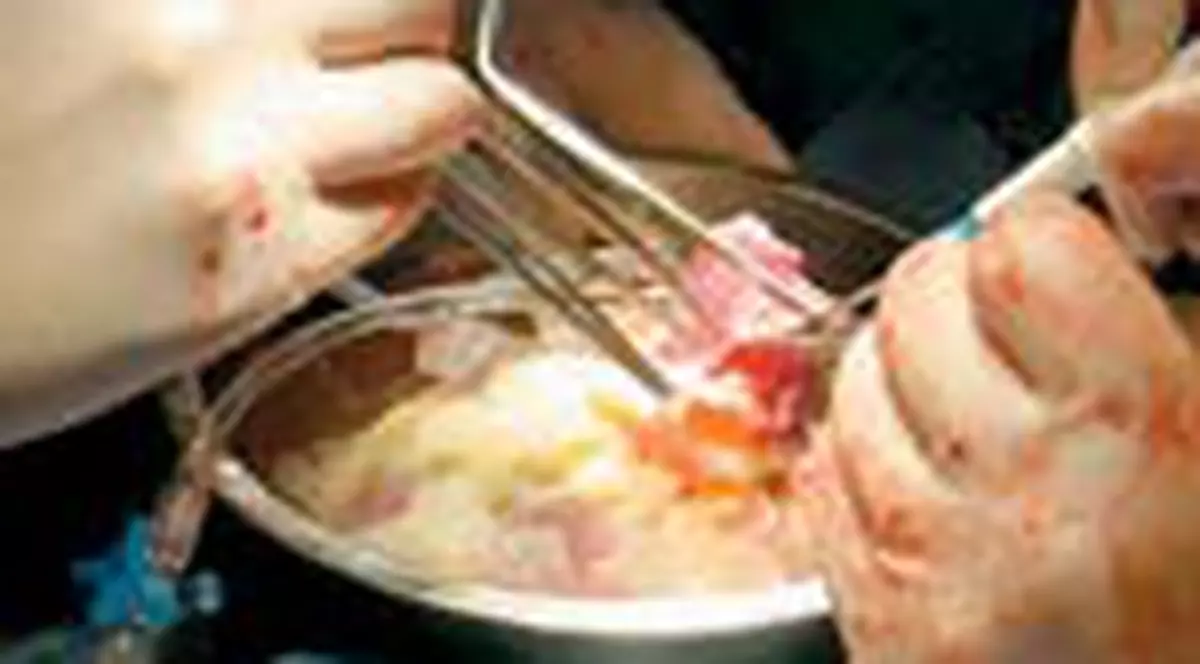 Transplant de personalitate?