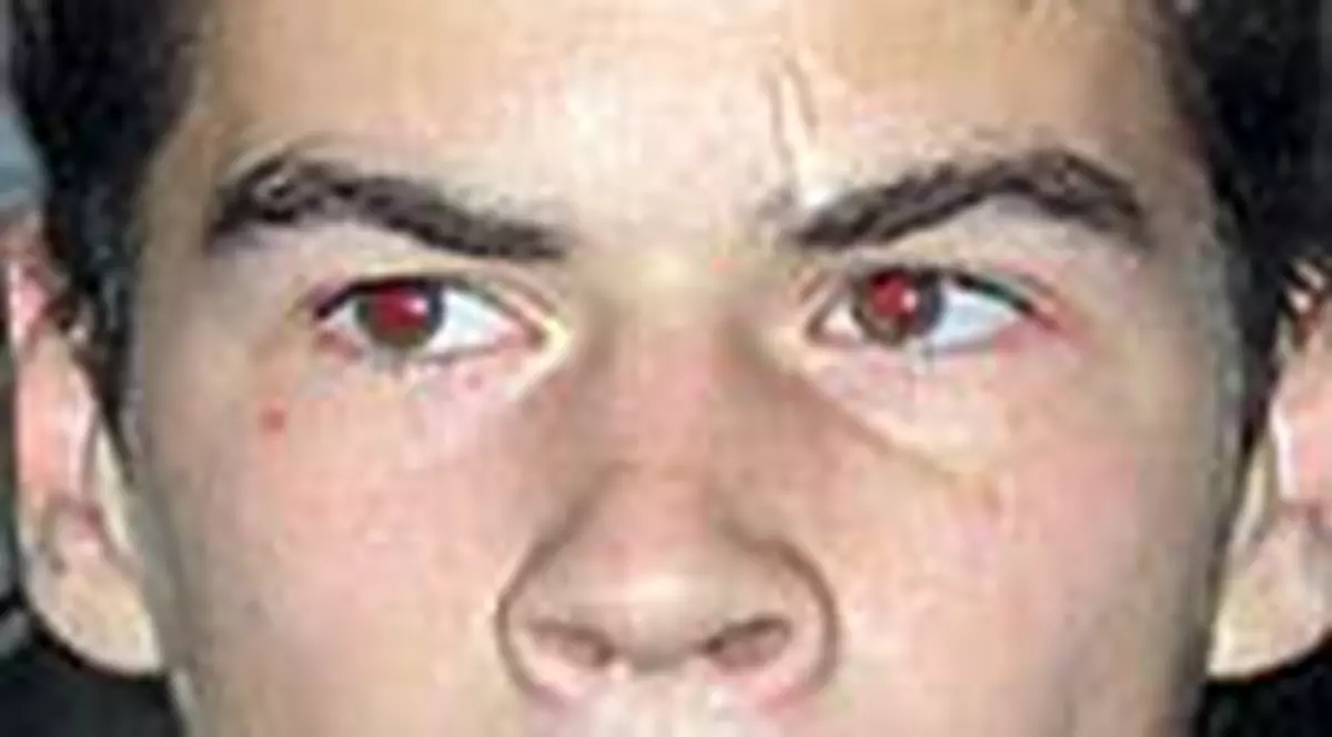 Ochirosii il ataca pe Bostina