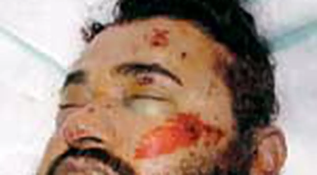 'Zarqawi a incercat sa fuga de pe targa'