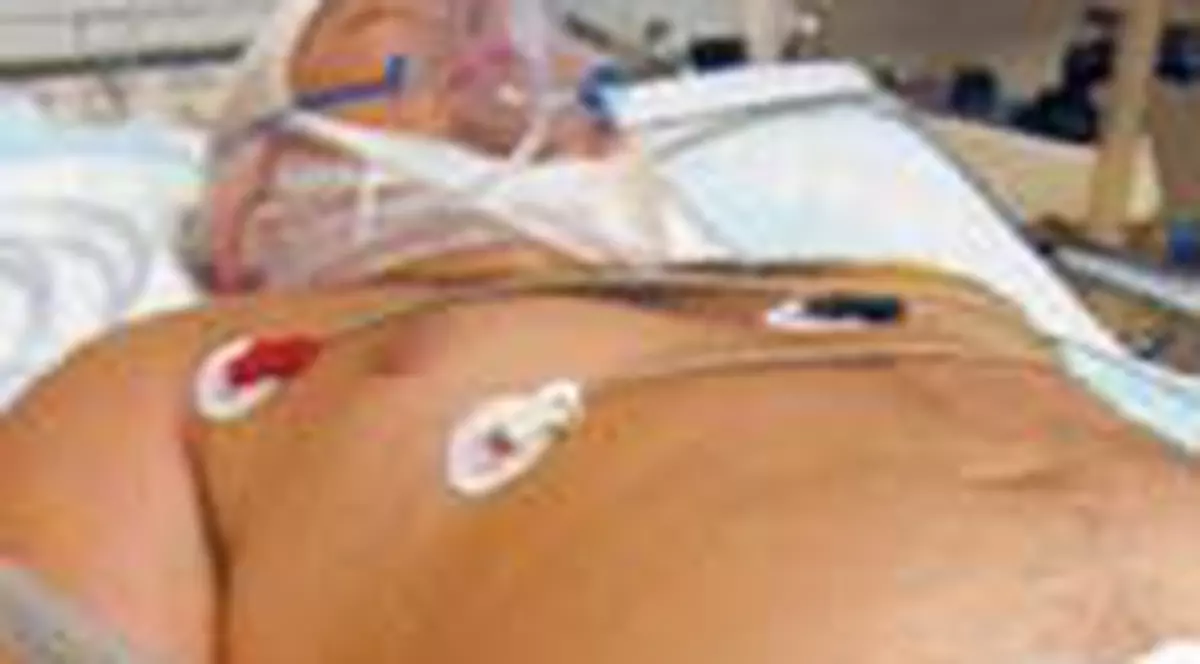 Costin a facut septicemie