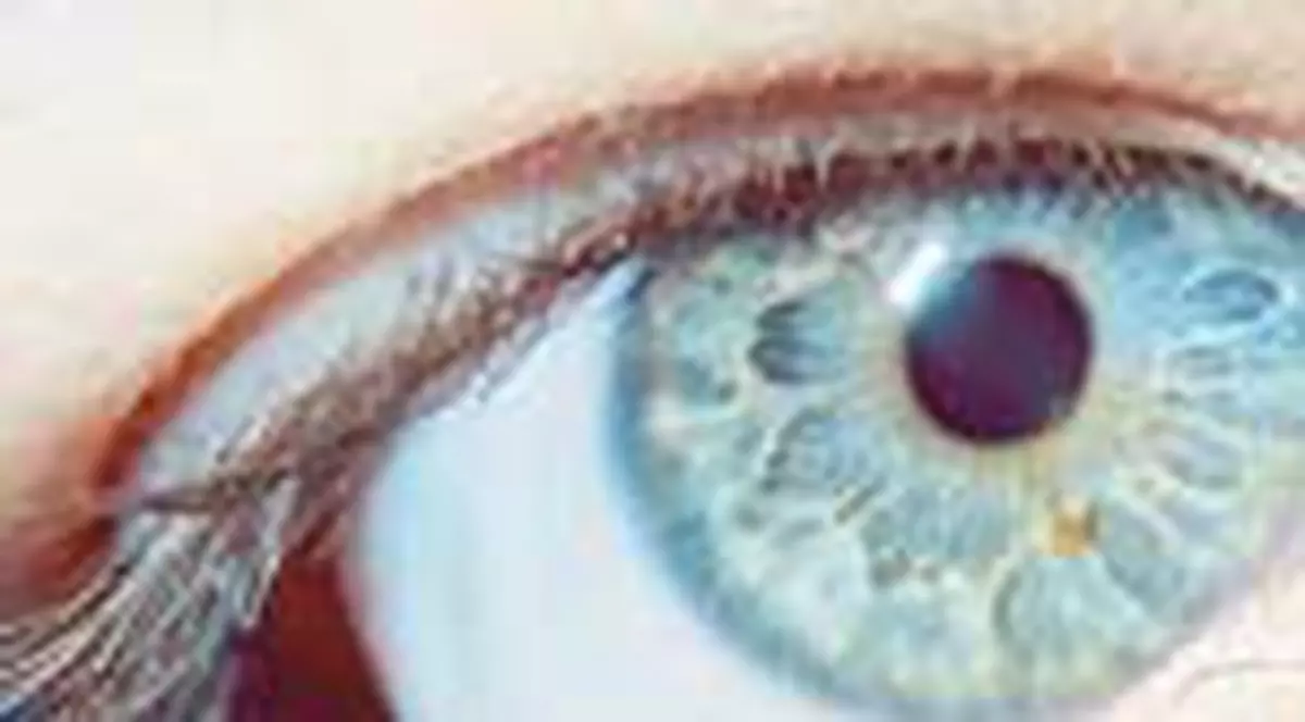 CHIRURGIA OFTALMOLOGICA SI LASERUL