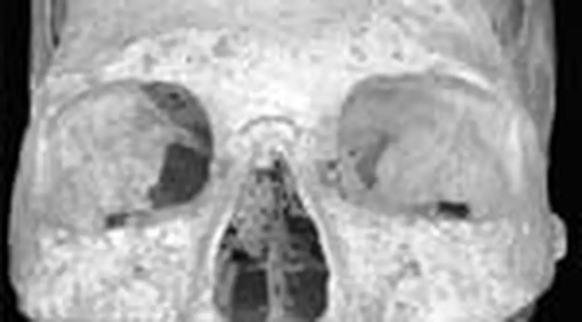 El e stramosul romanilor si are 40.000 de ani