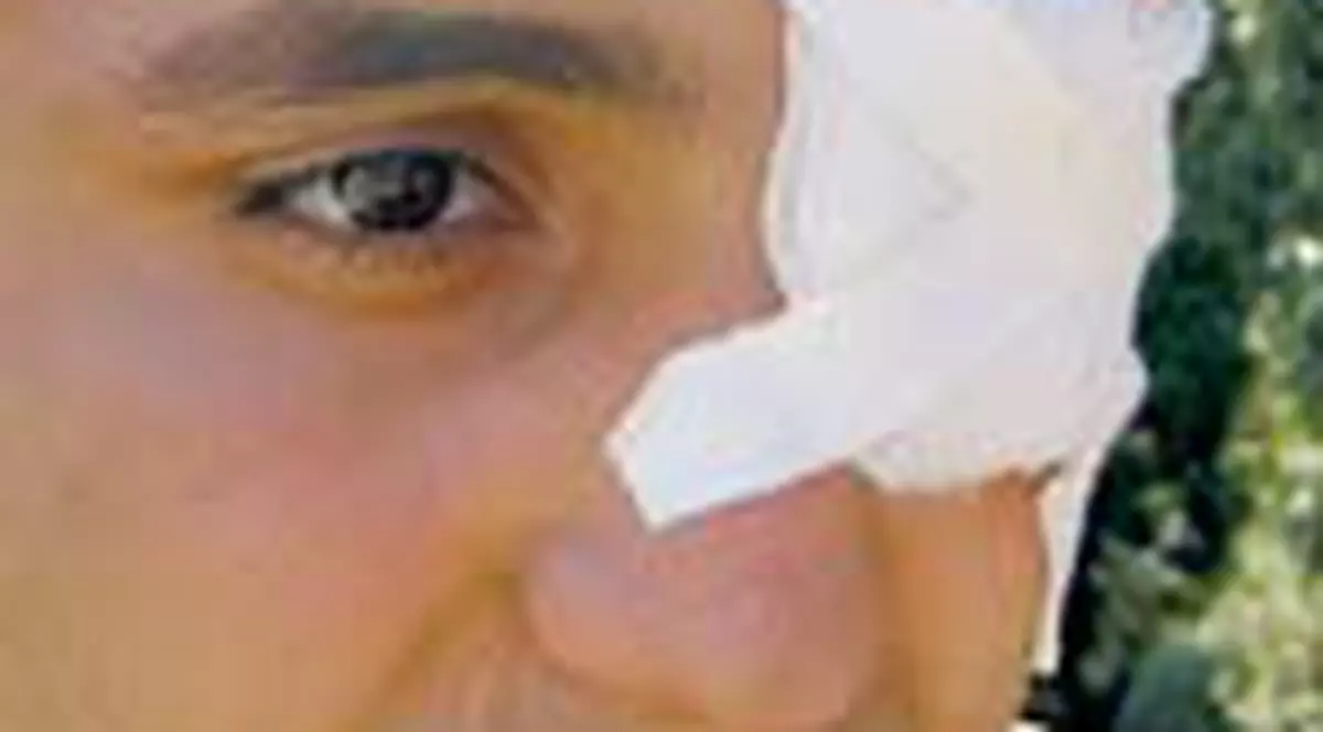 Va trai cu glontul in cap