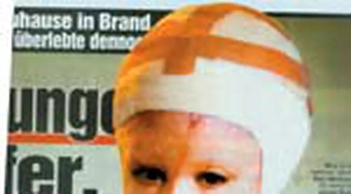 Operat de  30 de ori intr-un an