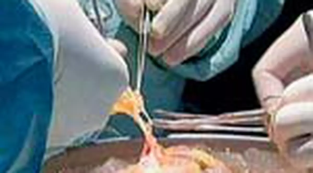 20 de medici, implicati de ieri in transplanturi-maraton in Capitala