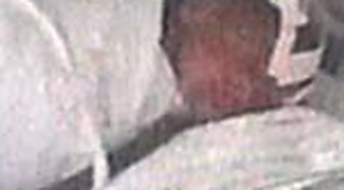 O fata de 14 ani, victima a proxenetilor, a nascut tripleti 