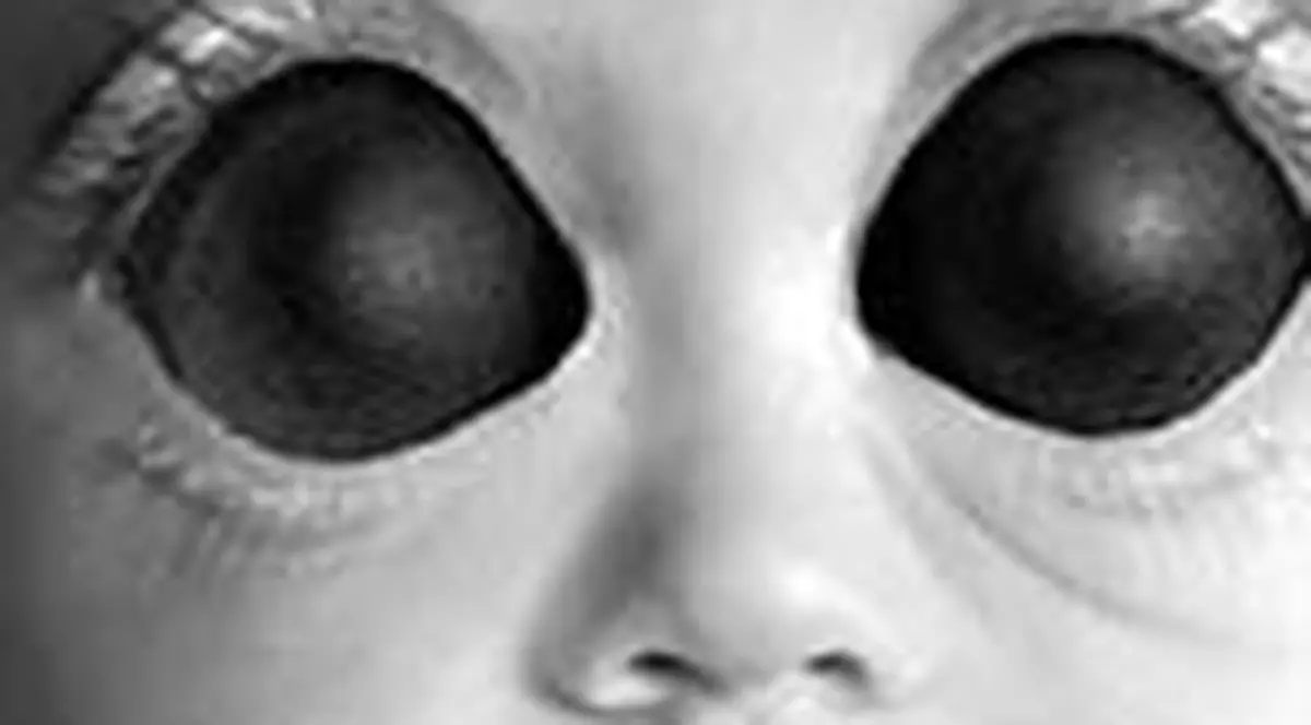 Copilul cu ochi de musca