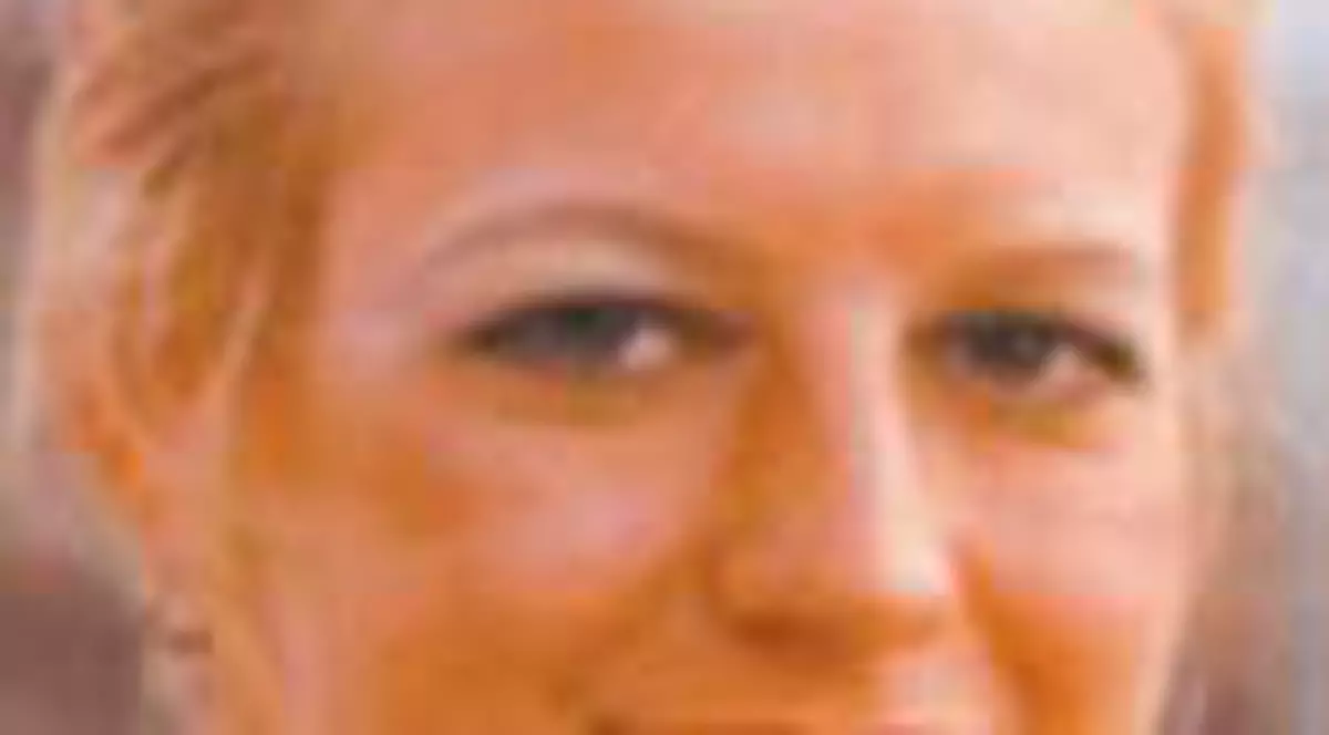 Si-a facut 40 de operatii estetice