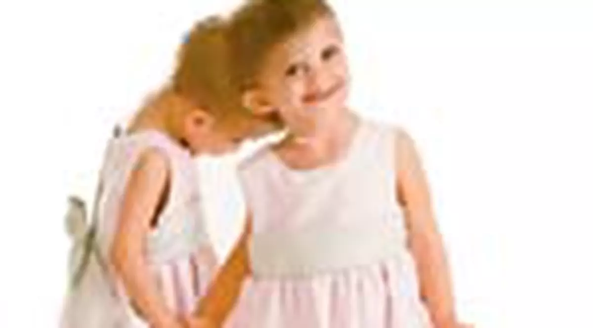 Medicii vor incerca sa le desparta iar