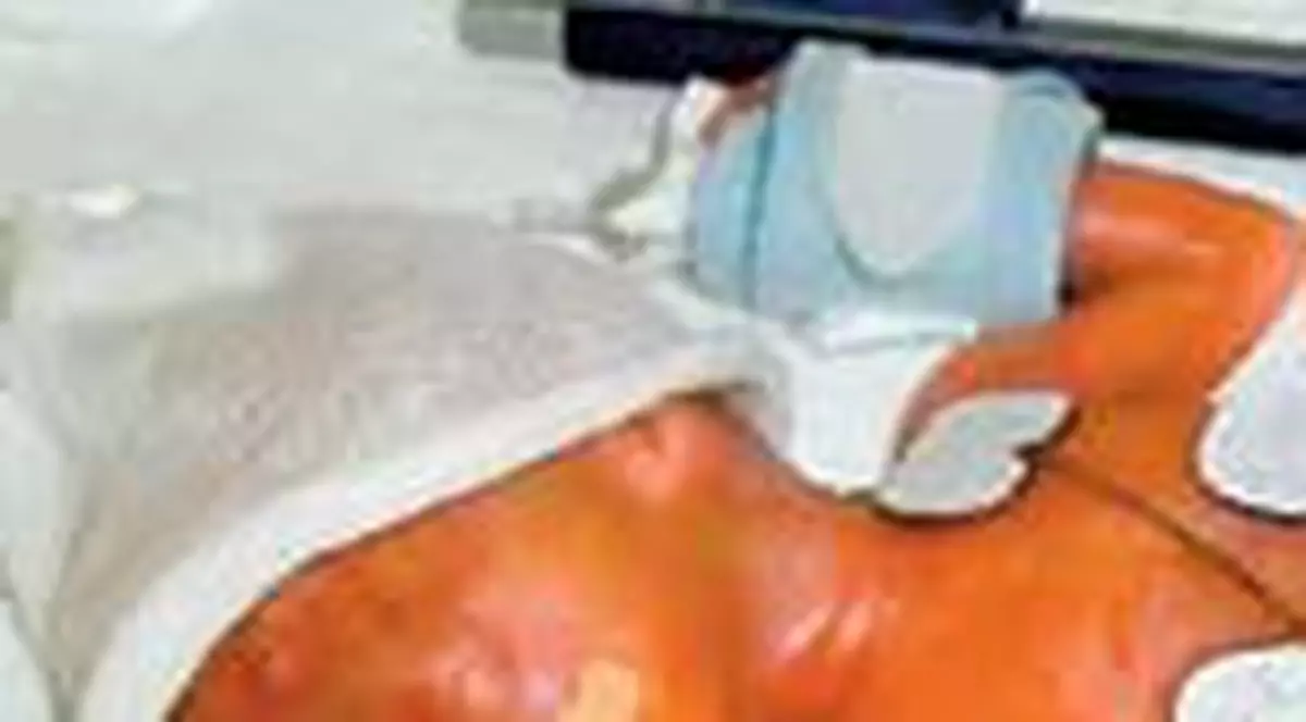 Fetita cat un pix iese din spital