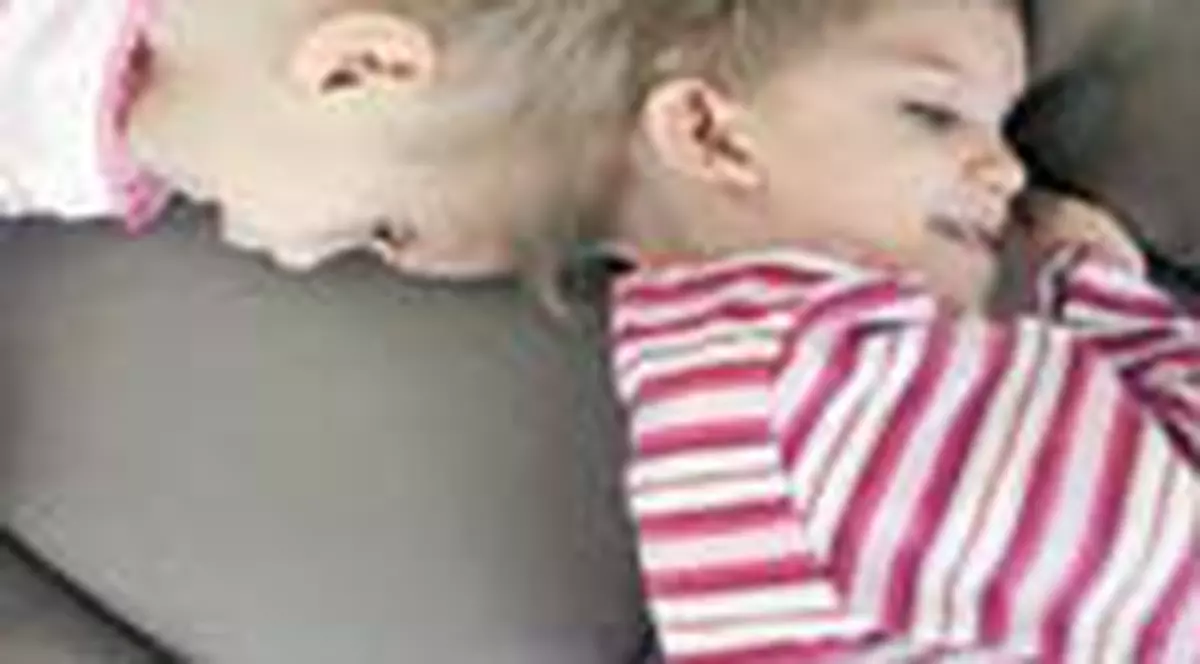 Siamezele romance ar putea fi separate in 2008