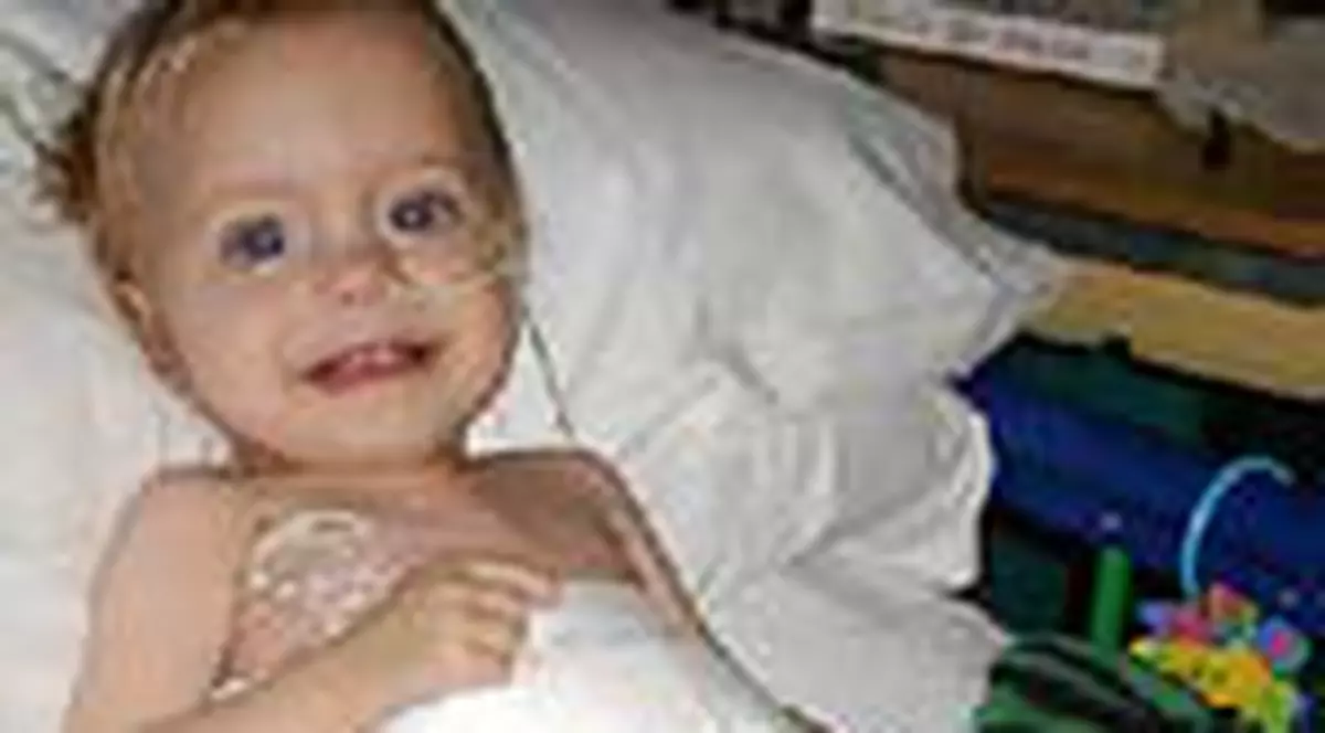 Un bebelus traieste cu o inima artificiala