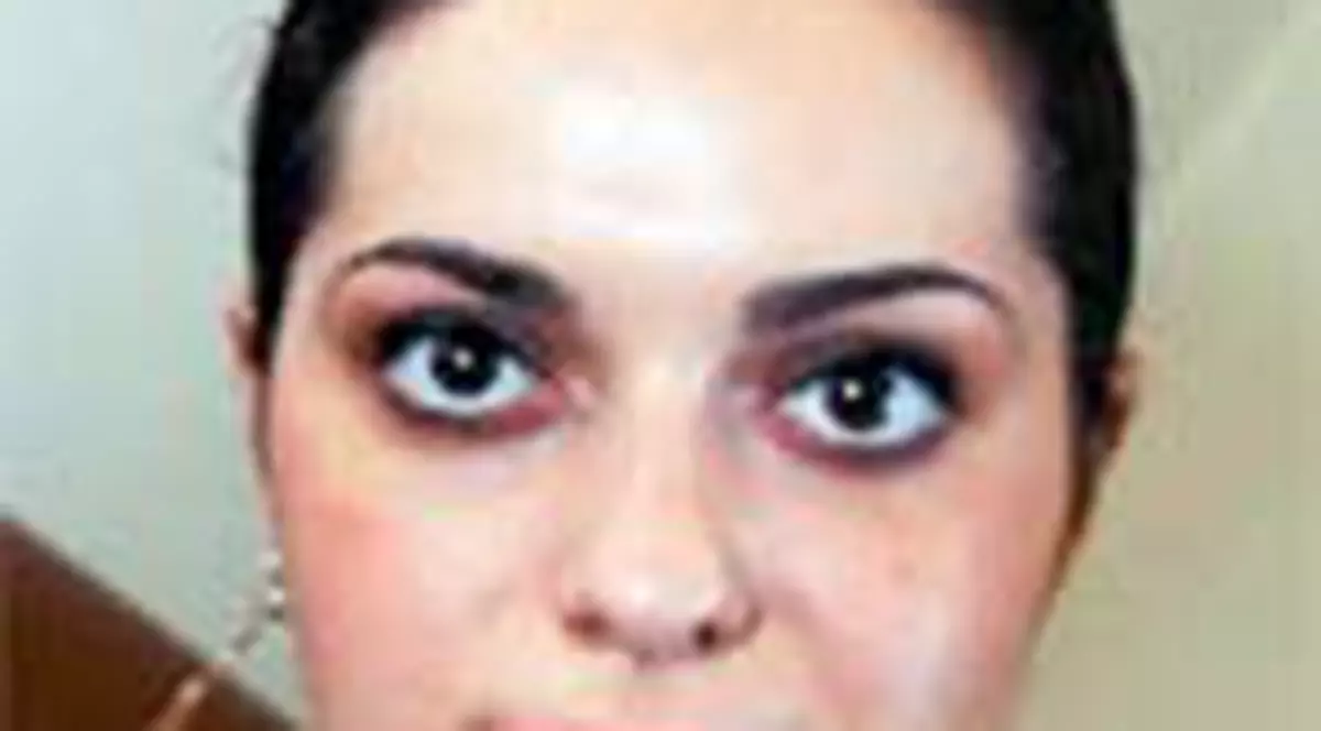 Vaduva lui Adrian Pintea, atacata in casa de propriul caine