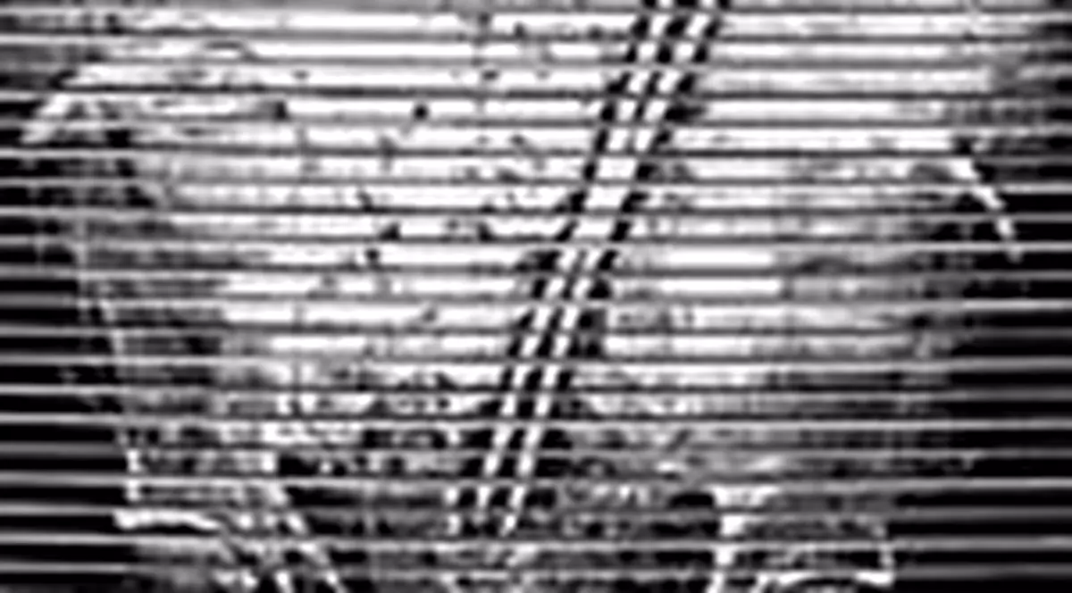 Doctorii i-au uitat o clema de 38 de cm in abdomen