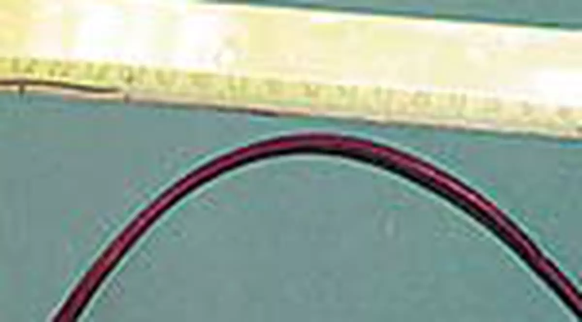 A trait 10 ani cu un tub in stomac