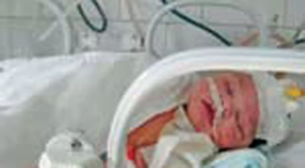 Bebelus chinuit cu doua operatii