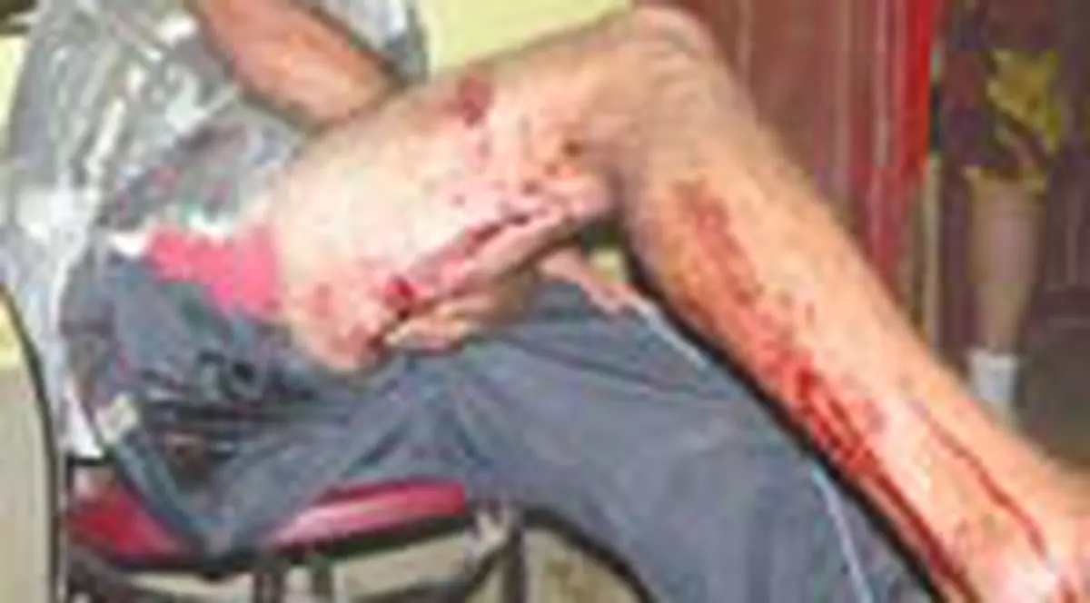 Victimele bataii de la Obarsia de Camp sunt inca in spital