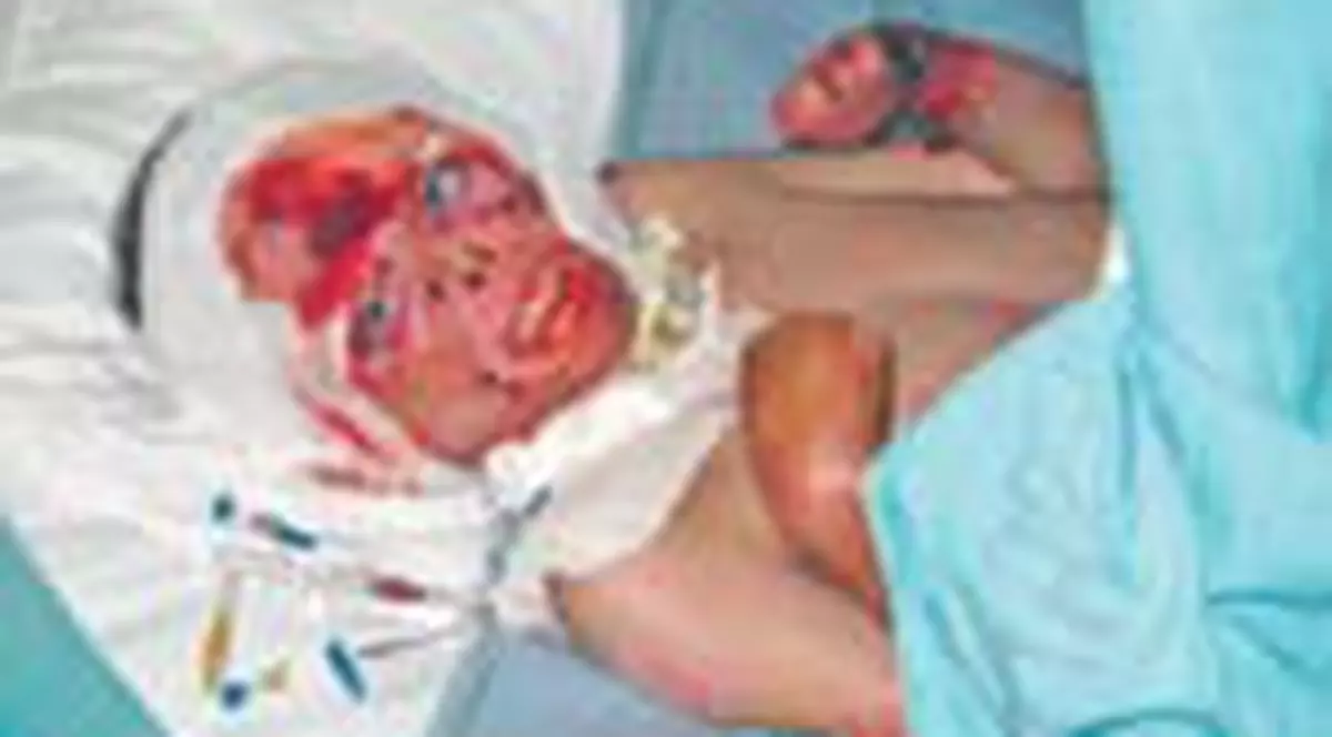 Un copil roman ars va fi salvat de o familie americana