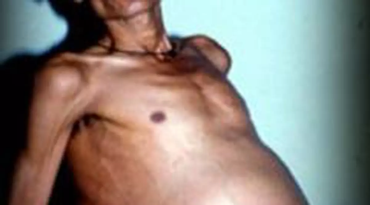 Un bătrânel de 71 de ani e.... însărcinat