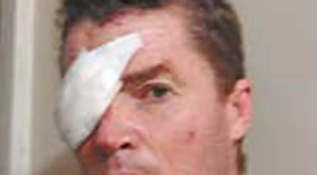 Batut pentru ca factura la intretinere e prea mare