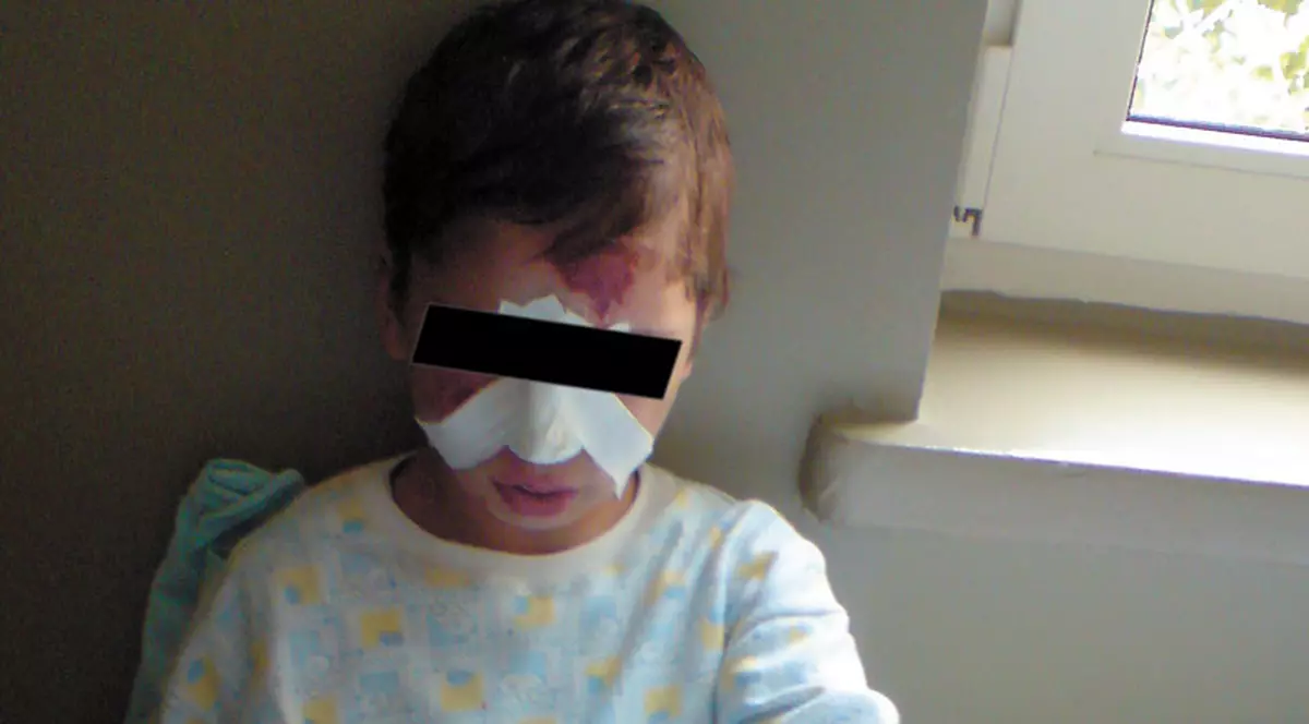 Copil bătut şi ars cu ţigara de mama lui 