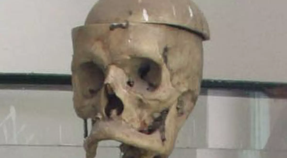 Craniu găsit într-o pădure din Buzău
