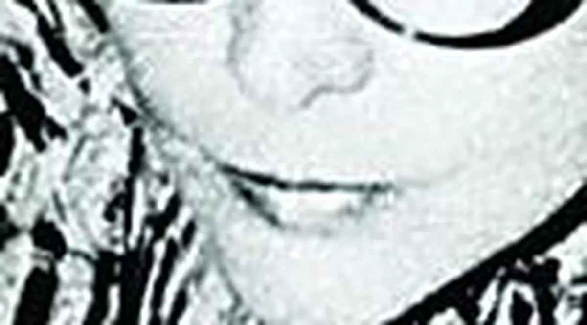 A murit după ce a stat 28 de ani în comă