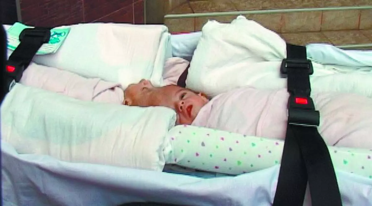 Vor să îi separe pe siamezii din Braşov!