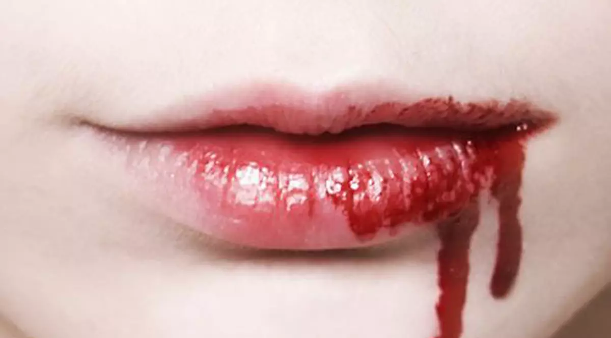 Cercetat de poliţie pentru că l-a muşcat de buză pe colegul fiului său